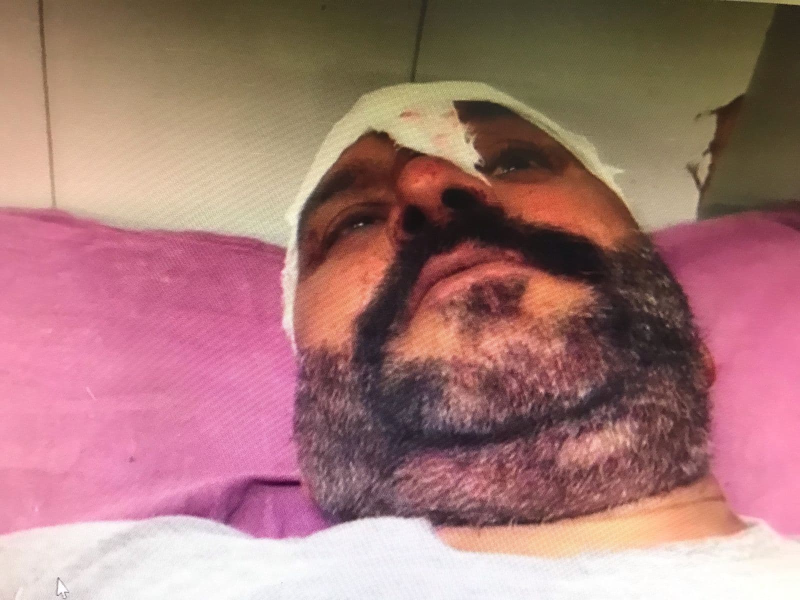 AAM ADMI PARTY के MC पर जानलेवा हमला