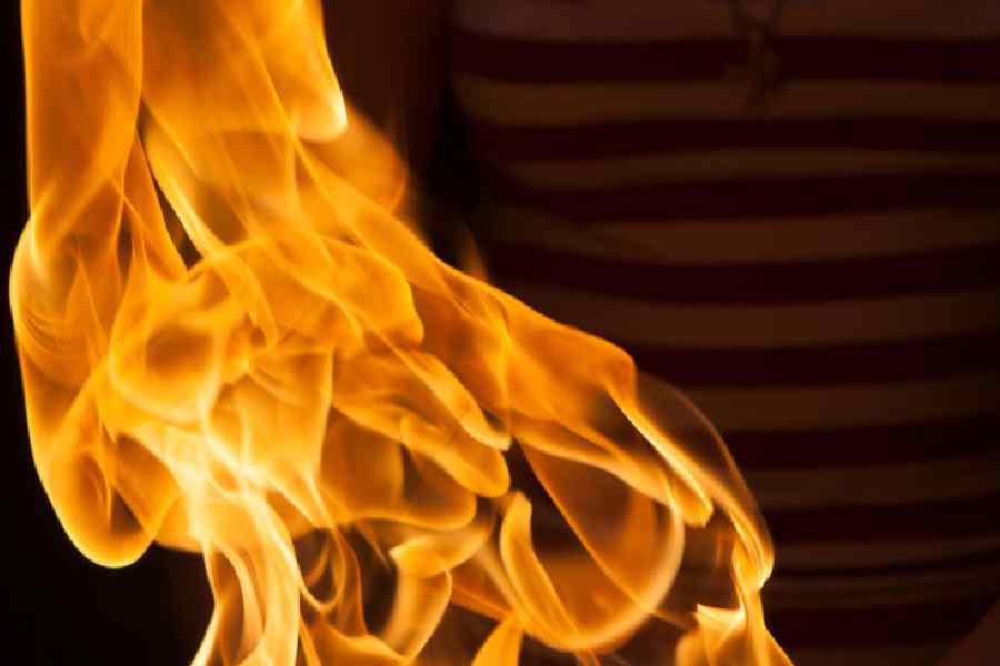 Film Industry discrimination: hairstylist ने खुद को आग लगाई, आरोप -एक लॉबी उसे काम देने से रोक रही