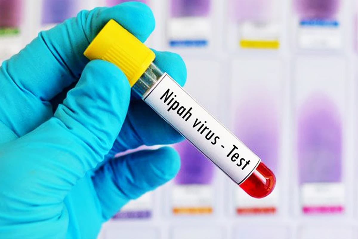 Nipah Virus: ऑक्सफोर्ड ने वैक्सीन का मानव परीक्षण शुरू किया